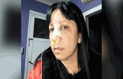 Violencia y agresiones contra una mujer en Mataderos