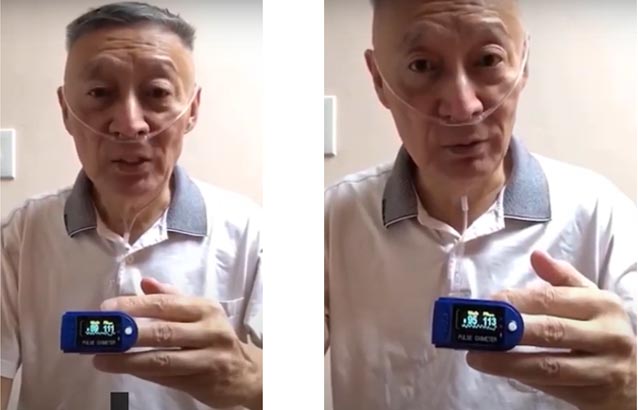 Las técnicas que usó el Sr. Gu para aumentar el oxígeno en la sangre estando gravemente afectado e internado por el Covid-19