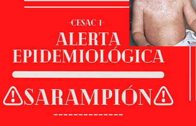 El CeSAC 1 de Barracas informa sobre alerta epidemiológica