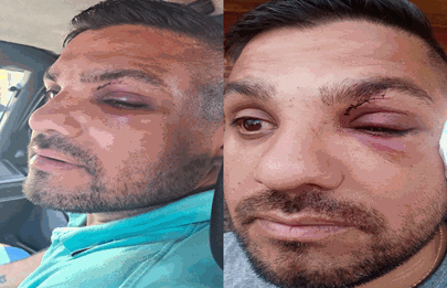 Reprimido por la policía de la Ciudad, no pudo ir a trabajar y lo echaron