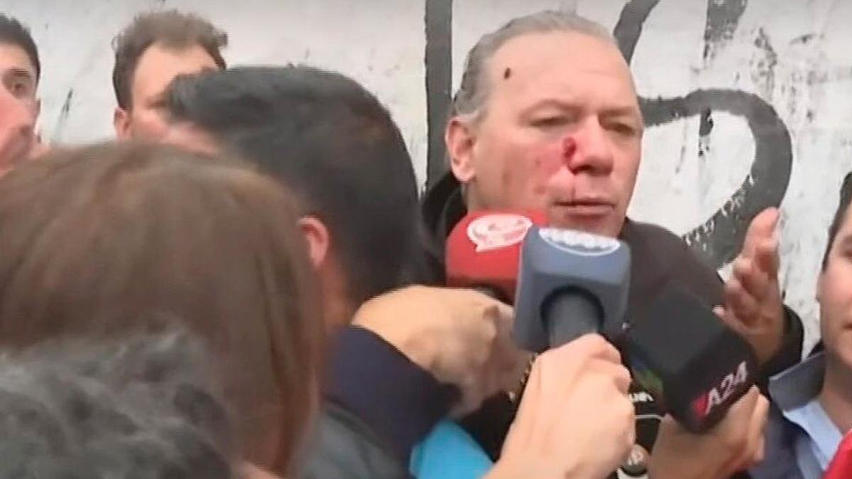 Berni descarta renunciar a su cargo y aseguró que no denunciará a sus agresores