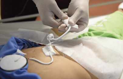 Enfermería del Garrahan presentó un programa para reducir las infecciones relacionadas al uso de catéteres