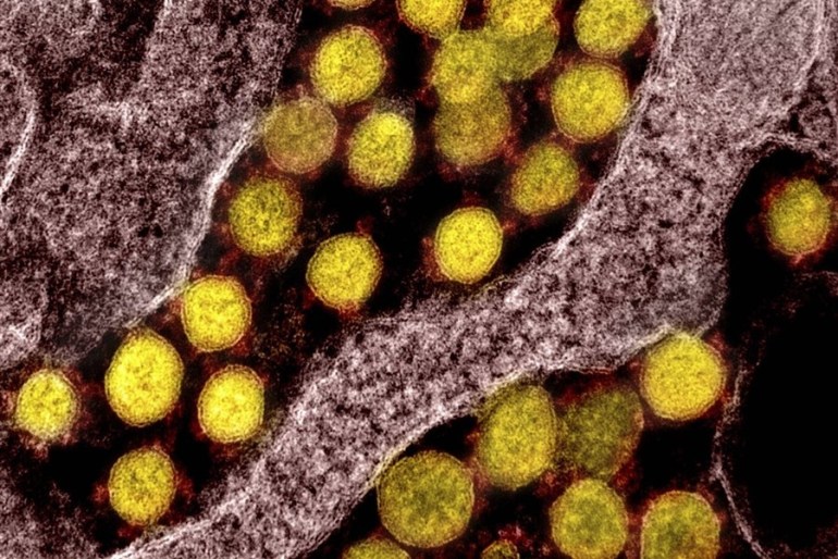 Covid: La nueva subvariante Eris se detectó en la Ciudad de Buenos Aires