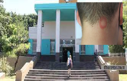 Medica del Santojanni advierte sobre aumento casos de  un hongo en cuero cabelludo