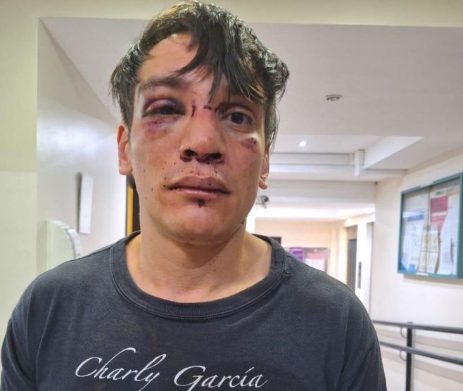 ACVI y AMMAR denuncian que la Policía de la Ciudad golpeó y detuvo de forma irregular a un abogado en la marcha universitaria: ya fue liberado