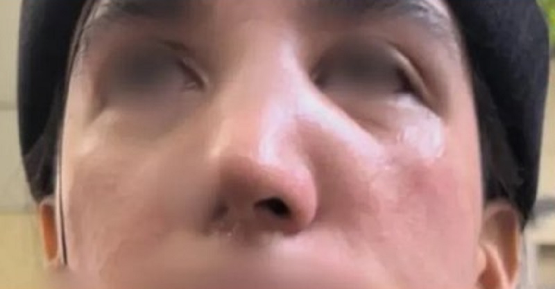 Una pareja de lesbianas fue agredida en Recoleta: a una mujer le rompieron la nariz