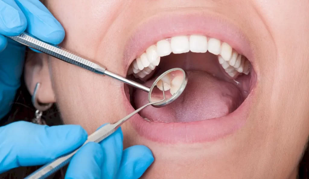 La importancia de visitar periódicamente al odontólogo