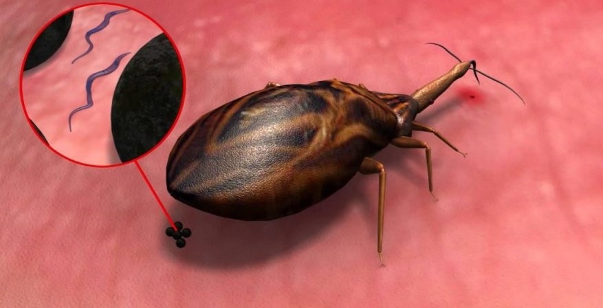 Chagas, enfermedad Parasitaria