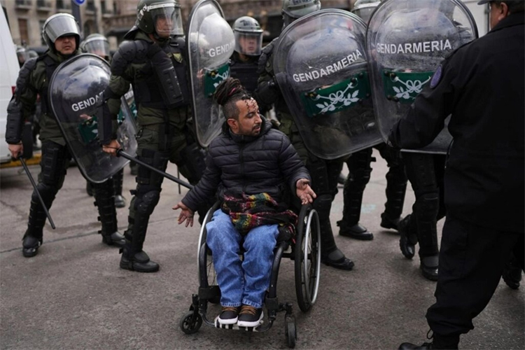 La Justicia federal ordenó restituir en 24 horas las pensiones por invalidez laboral suspendidas en todo el país
