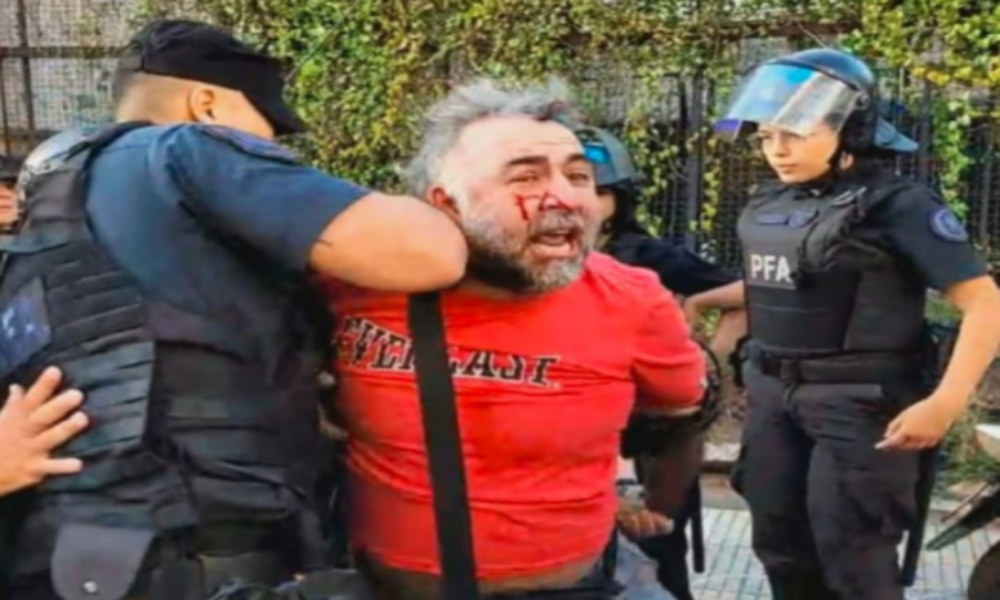 Represión a periodistas de A24 en cobertura frente al Congreso: sindicato denuncia precarización laboral